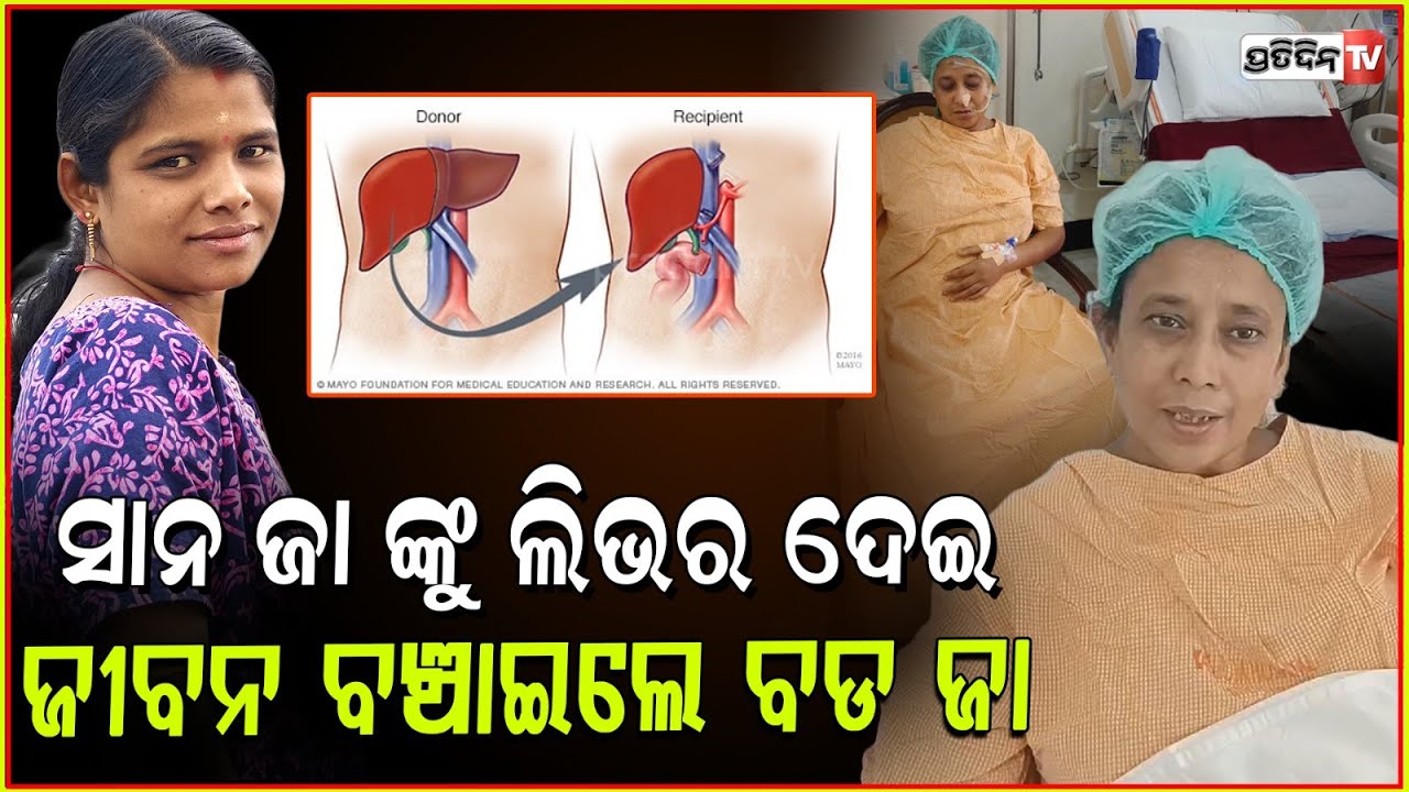 ବଡ଼ ଯା ଲିଭର୍ କଲେ ଦାନ, ସାନ ଯାଙ୍କ ବଞ୍ଚେଇଦେଲେ ଜୀବନ। Sister in law saves life donates liver, Sambalpur.