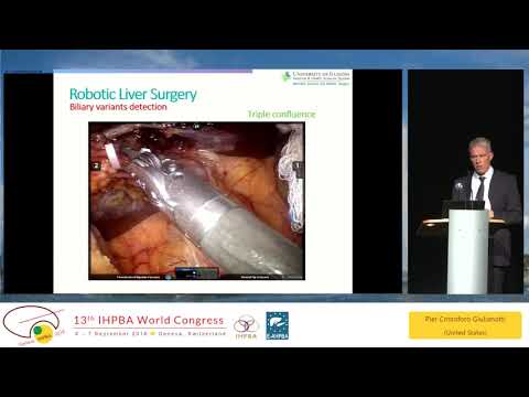 DEB09.1 Will Robotics Replace Laparoscopic Liver Surgery?