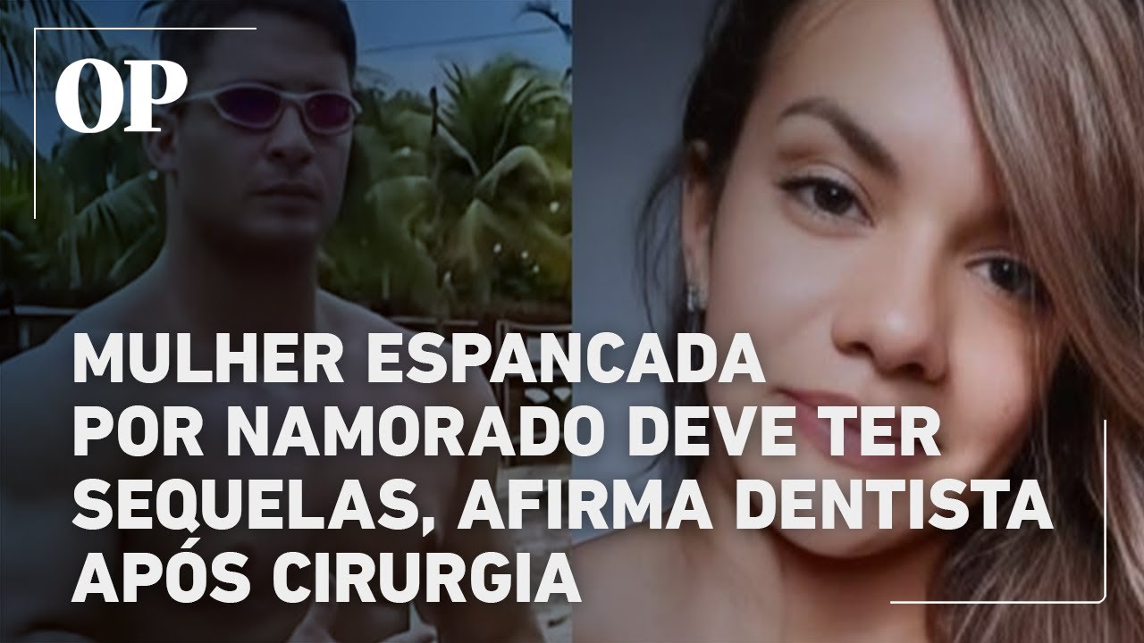 Mulher espancada por namorado deve ter sequelas afirma dentista após cirurgia
