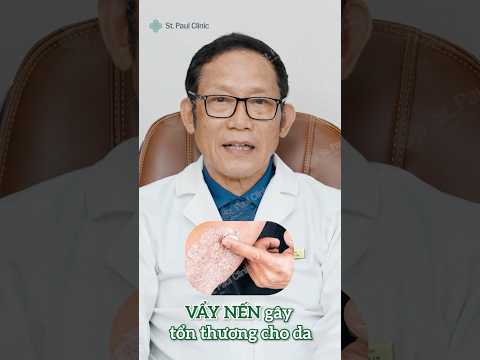 VẨY NẾN: Tại sao da DỄ BẦM TÍM sau va chạm nhẹ?