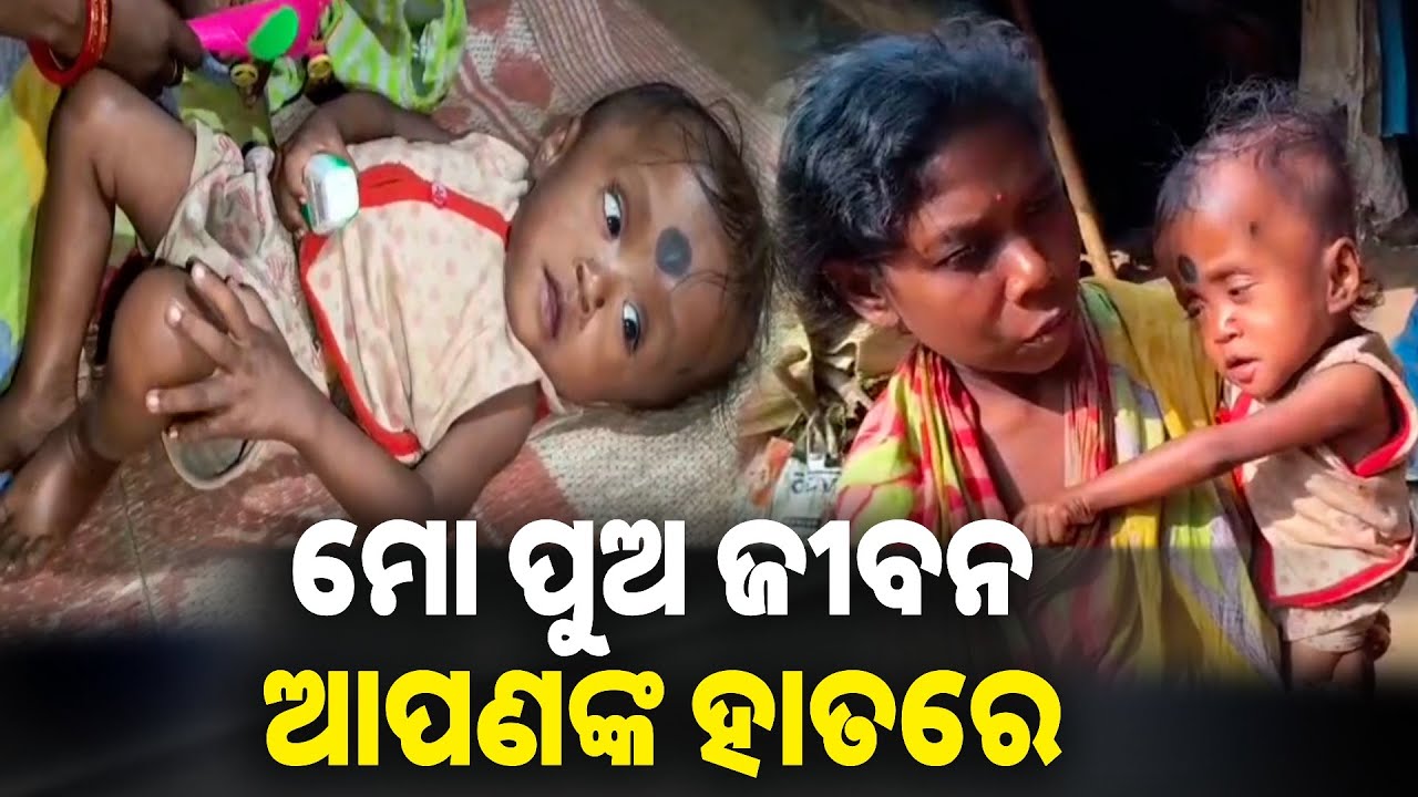ଦୁଇ ବର୍ଷର ପୁଅ ଶିବକୁ ବଞ୍ଚାଇ ପାରିବ କେବଳ ଆପଣମାନଙ୍କ ସାହାଯ୍ୟ || knews odisha