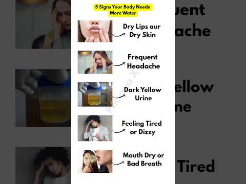⚠️ Don’t Ignore These 5 Signs of Dehydration! || #shorts #viral #healthtips