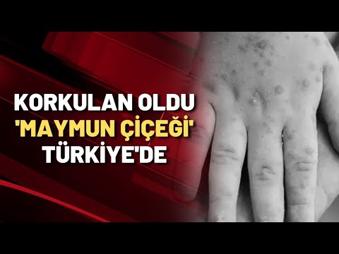 KORKULAN OLDU 'MAYMUN ÇİÇEĞİ' TÜRKİYE'DE