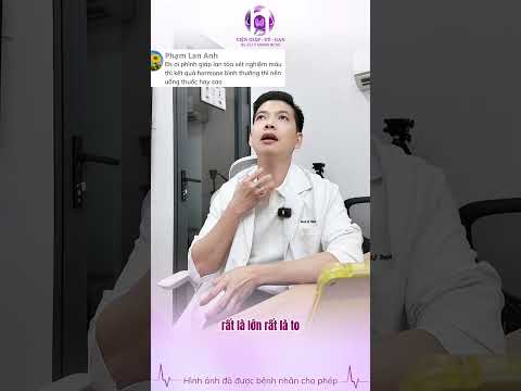 Phình giáp lan tỏa chỉ số hormone bình thường có cần uống thuốc không?