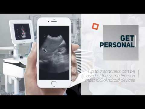 Cart ultrasound gets personal Cart ultrasound gets personal