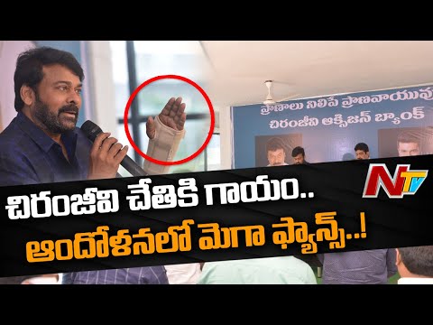 Chiranjeevi undergoes surgery in his right hand palm Chiranjeevi undergoes surgery in his right hand palm