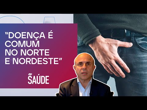 Como a combinação de tratamentos pode reduzir o câncer de pênis? | Dr. Fernando Maluf