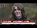 BREAKING: Kate Middleton says she is being treated for cancer in video announcement  - 03:15 min - News - Video