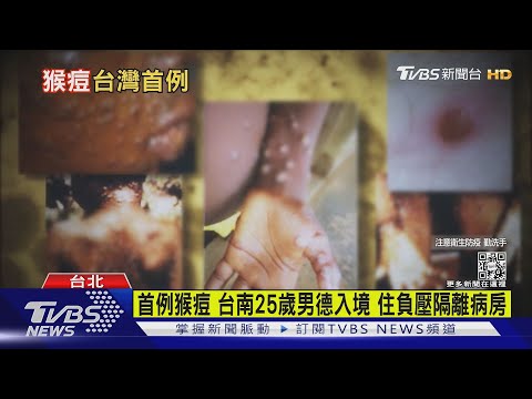 首例猴痘 台南25歲男德入境 住負壓隔離病房｜TVBS新聞