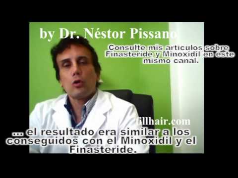 El medio más eficaz de la alopecia de hombre