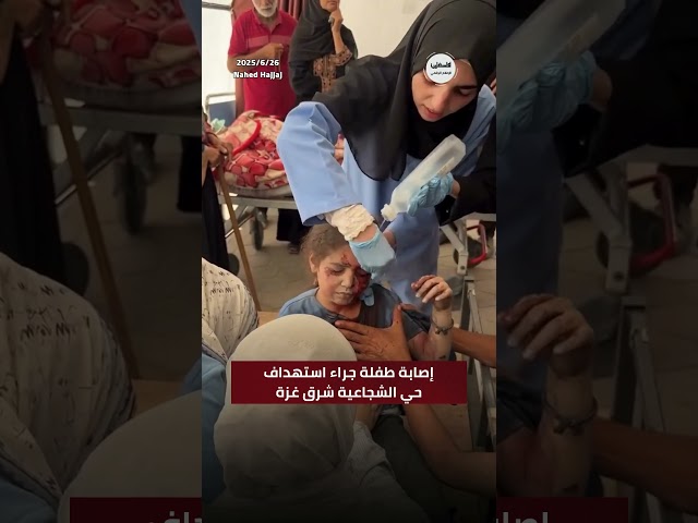 #شاهد وصول طفلة الى مستشفى المعمداني جراء إصابتها بقصف الاحتلال لمنزل في حي الشجاعية شرق غزة