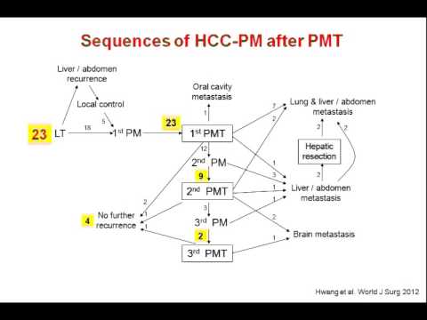 Treatment of Pulmonary Metastasis from Hepatocellular Carcinoma 