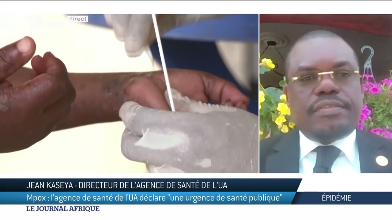 Mpox : l'Africa CDC déclare une "urgence de santé publique"