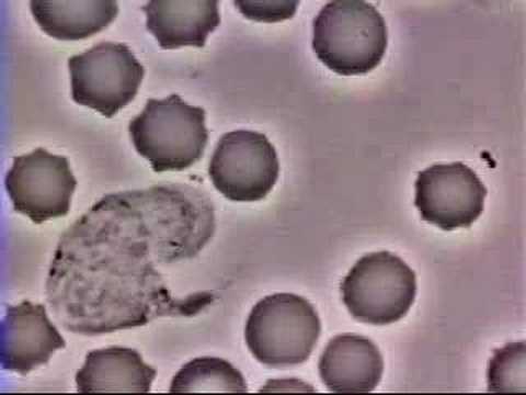 Λευκά αιμοσφαίρια-βακτήρια