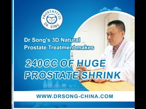 Latest Enlarged Prostate Treatment makes 240cc of Huge Prostate Shrink - No surgery-Natural Cure