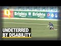 Physically Challenged Cricketer’s Spectacular Fielding Effort