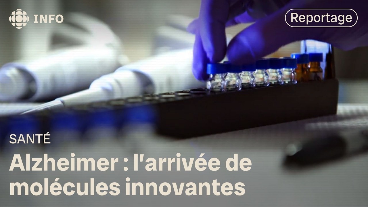 Nouveaux traitements contre l'alzheimer : entre espoir et controverse | Découverte