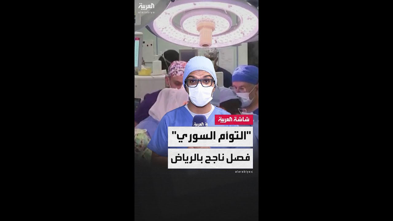 كاميرا العربية ترصد المرحلة الرابعة من عملية فصل التوأم السوري