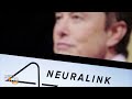 Neuralinks Human Brain Implant Stumbles in Debut  - 01:06 min - News - Video