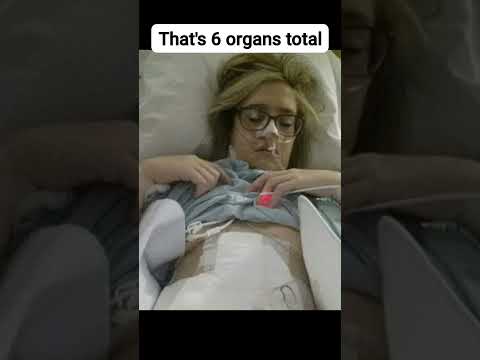 You won't believe this. #organtransplant #kidney #hospital #transplant #chronicillness #medical