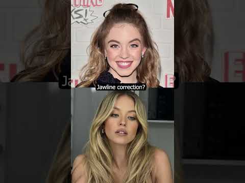 Can you guess the plastic surgeries sydney Sweeney has gotten done?