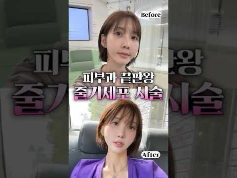 젊어지는 끝판왕 시술 후기