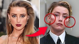 What “Happened” to Amber Heard’s Cheeks? Plastic Surgery Update