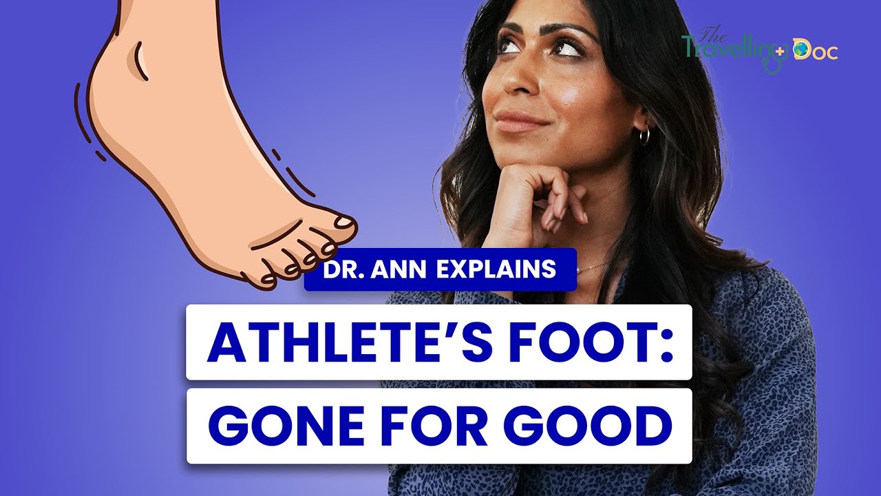 Athlete's foot is not just limited to athletes, it can affect anyone who wears closed-toe shoes and sweats a lot. If you're one of the millions of people dealing with this pesky and uncomfortable condition, this video is a must-watch. Our experienced podiatrist will explain the different types of athlete's foot and the best treatment options for each. We'll also debunk common myths and provide you with helpful tips to prevent future flare-ups. Don't let athlete's foot take control of your life – watch this video and take back your healthy feet!

✅ FOLLOW ME and Subscribe now, and let's get started on your path to well-being! 💪🏥
👉 Bio: https://linkin.bio/the-travellingdoc  
👉 Website: https://TheTravellingDoc.com/ 
👉 Instagram: https://www.instagram.com/the.travellingdoc/  
👉 Twitter: https://twitter.com/TravellingDocUK
👉 LinkedIn: https://www.linkedin.com/company/the-travelling-doc
======================================

🌟 Embark on a voyage of discovery with me, Dr. Ann, as your dedicated physician. I'm here to empower you with the knowledge and insights you need to lead a healthier, happier life.

📚 From expert doctor's advice to practical tips, I'm committed to providing you with the guidance you deserve.

🩺 Your well-being is my priority, and together, we'll navigate the path to a healthier you. So, hit that "Subscribe" button and join our ever-growing community of health-conscious individuals.

🌐 For even more valuable resources, visit my website at https://TheTravellingDoc.com/. Your health journey begins here, and I'm thrilled to be your trusted guide.
======================================

✅ Other Videos You Might Be Interested In Watching:

👉 Urine Infections Symptoms, Treatment, Cystitis, Doctor explains
https://www.youtube.com/watch?v=BG4Q0zs5nSs

👉 GENITAL WARTS - Doctor Explains
https://www.youtube.com/watch?v=Bh7XUq0HORE

👉 HPV Vaccine - HPV Myths + HPV Facts + HPV virus
https://www.youtube.com/watch?v=ig7q1H474Y4

👉 Welcome to my page
https://www.youtube.com/watch?v=TsFJLneyvwU
 
===============================

✅ Welcome to TheTravellingDoc.

Dr. Nainan is a family medicine doctor with over 10 years of experience. She obtained her MBBS from Keele University and holds diplomas from The Faculty of Sexual and Reproductive Medicine. Dr. Nainan has also received further training on tropical diseases with Doctors Without Borders. 

She has worked at various Trusts in the UK and has international medical experience in South Africa, India, and Bangalore. Her approach to well-being is holistic, addressing physical, mental, and spiritual health to develop a comprehensive treatment plan. 

Dr. Nainan focuses on urgent care for acutely unwell patients and also provides telemedicine services for chronic and new health concerns, utilizing health technology to ensure the accurate and safe medical information is accessible.

🔔 Don't forget Please Subscribe to My Channel to get more health-related Videos: https://www.youtube.com/@TheTravellingDoc

======================================

#athletefoot #fungalinfections #footinfection 

Disclaimer: The Video Content on this channel is for educational purposes and not intended to be a substitute for professional medical advice, diagnosis, or treatment. Always get advice from your doctor if you are worried or have symptoms.

Copyright Notice: This video and our YouTube channel contain copyrighted music and images. Any public, media, and other business usage are subject to a business license. Unauthorised usage and publications are prohibited. 

© TheTravellingDoc