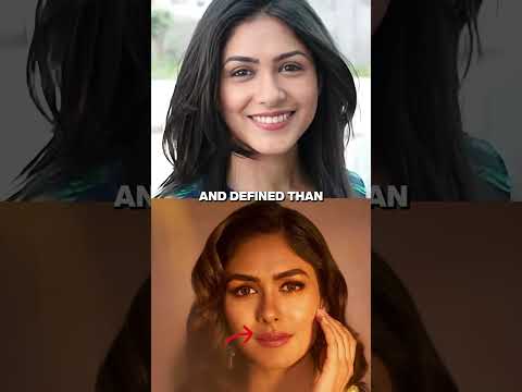 Which plastic surgeries Mrunal Thakur has undergone?