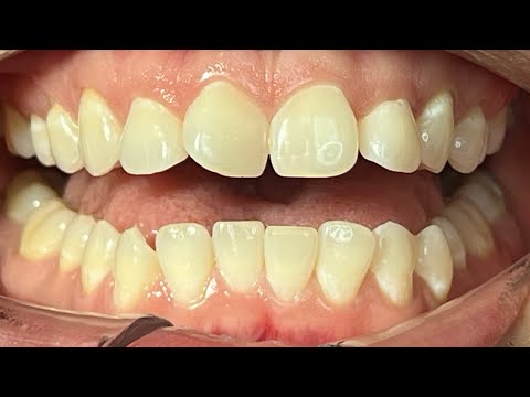 10 Things General Dentists Need To Know Before Start Ortho Cases