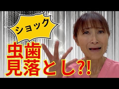 要注意！虫歯を見落とさないために歯医者さんでできる重要なこと