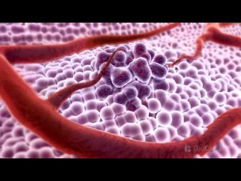 Upload mp3 to YouTube and audio cutter for 3D Medical Animation - What is Cancer? download from Youtube