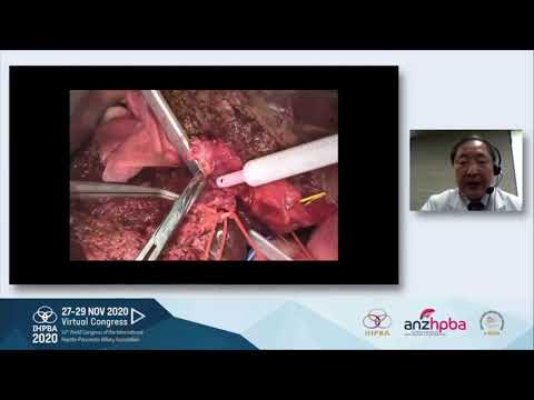 LL01: Masaru Miyazaki, Aggressive Surgical Strategies for Advanced Bilio-Pancreatic Malignancies