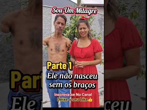 Sou um milagre PARTE 1 Ele não nasceu sem os braços