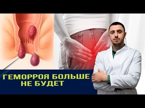 Как вылечить геморрой навсегда простыми методами