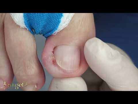 Variação anatômica #satisfying 