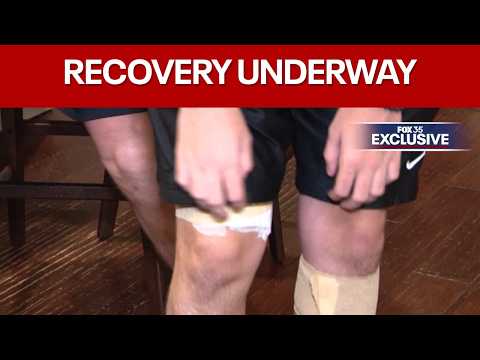 Teen recovers after <strong>being</strong> attacked by pack <strong>of</strong> 5 dogs