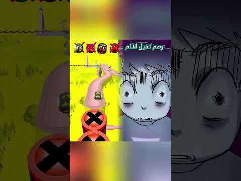 كانوا راح يقطعوا رجلي 😨 ✂️