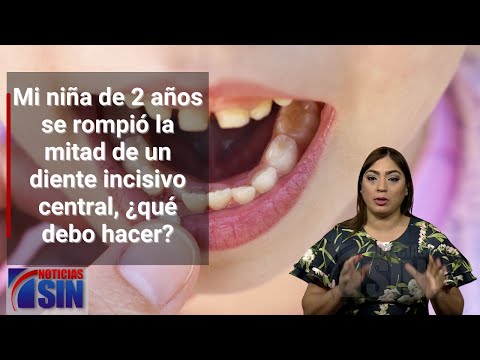 Mi niña de 2 años se rompió la mitad de un diente incisivo central, ¿qué debo hacer?