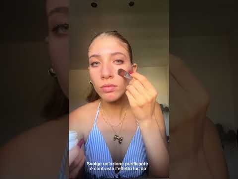 Acne: risultati prima e dopo Maria Elisa