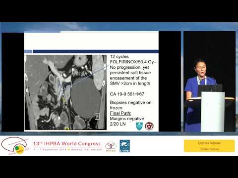 SS05.2 IHPBA Meets SSAT: Contemporary Approaches to Borderline Resectable Pancreatic Cancer