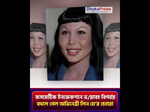 কসমেটিক ইনজেকশনে ভ/য়াবহ বি'পর্যয়,বদলে গেল অভিনেত্রী লিন মে'র চেহারা।#lynmay #actress #celebrity