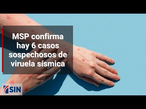 MSP confirma hay 6 casos sospechosos de viruela sísmica
