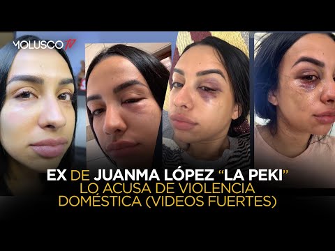 LA PEKI acusa de maltrato a EX Campeón Juanma López ( DISCRECIÓN CON LAS IMAGENES )