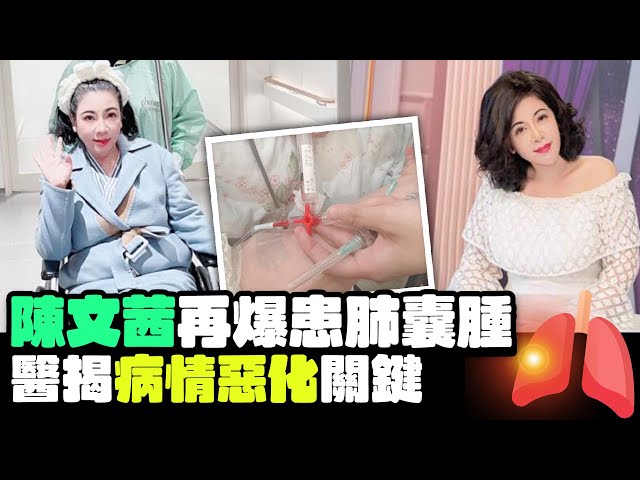 陳文茜癌末併發「肺囊腫」攻擊6器官　醫曝病情惡化關鍵  @ChinaTimes