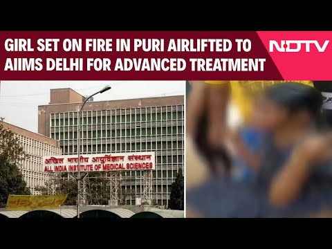 Odisha News | 15-Year-Old Girl Set On Fire In Puri Airlifted to AIIMS Delhi for Advanced Treatment