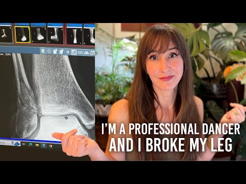 My Broken Ankle - A Professional Dancer's PT, Recovery, & Lingering Effects