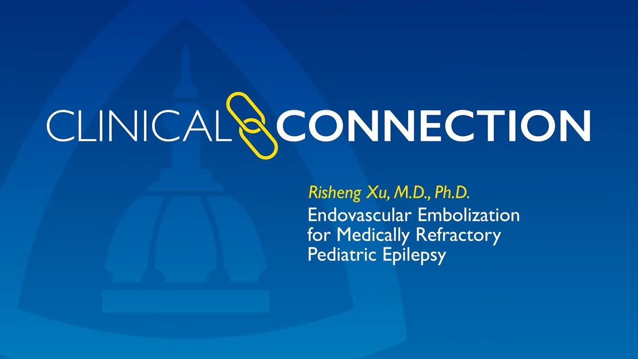 Endovascular Embolization for Medically Refractory Pediatric Epilepsy