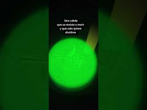 El origen del cáncer de mama