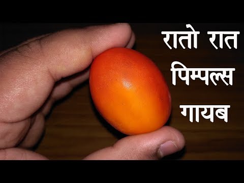 Tamatar से कील मुहांसे (Pimples,Acne) को जड़ से मिटने का उपाय / Tamato Se Pimples kaise hataye